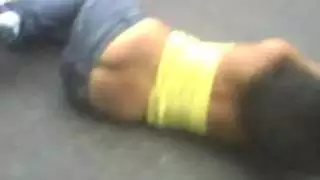 سكسي البزاز ممرضات