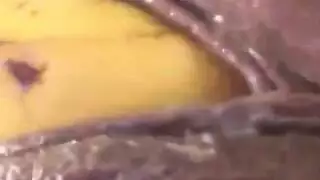 تقيؤ بازب