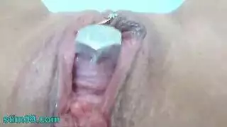 فحص طبي جامح: استكشاف شرجي صريح