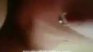حدب فني المملكة المتحدة